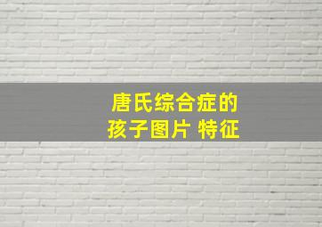 唐氏综合症的孩子图片 特征